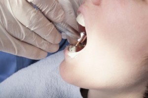 Gum Disease Treatment in Layton: Stop Gum Disease In It’s Tracks!